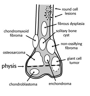 lucent vs lytic lesion.